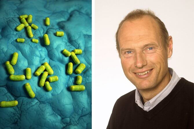 Modell av ett tandimplant